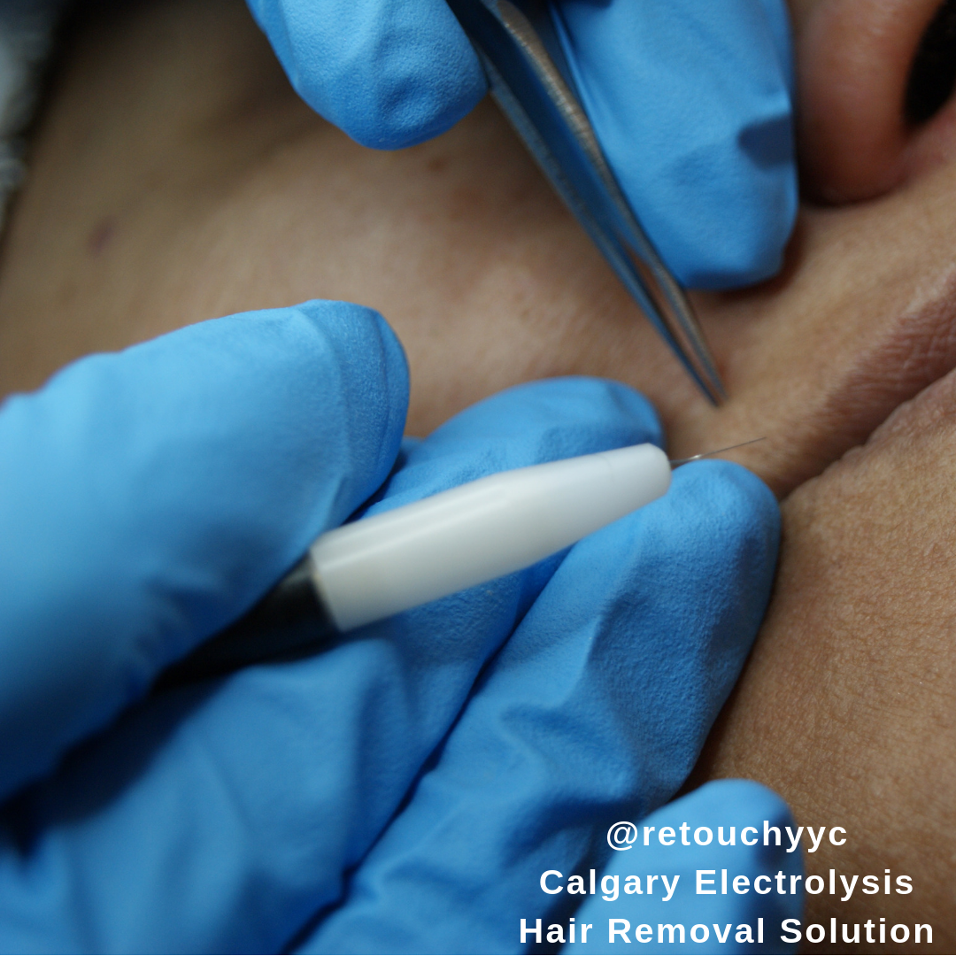 Retouch Epilation In Calgary CA AB Vagaro